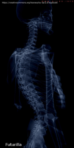 human xray